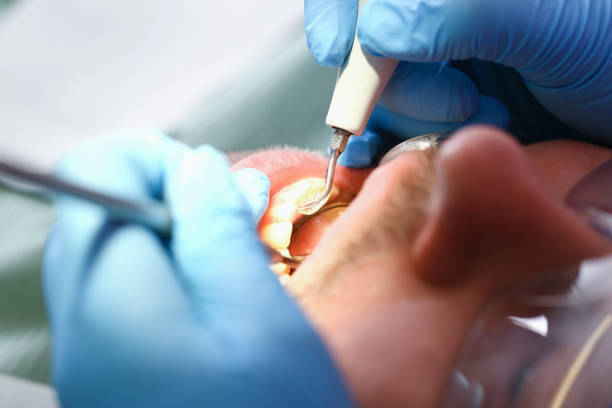 Best Emergency Treatment for Oral Infections in Briar, TX